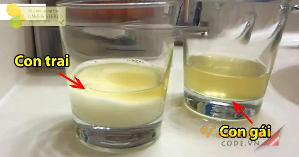 Mẹo nhận biết giới tính thai nhi khoa học, chính xác đến 90%