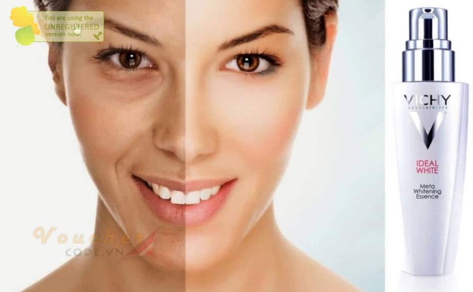 Review kem dưỡng ẩm, kem dưỡng trắng và kem trị mụn của Vichy