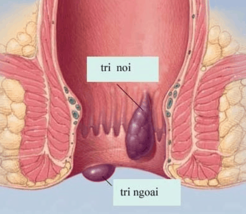 Sa-tri-co-nguy-hiem-khong-2