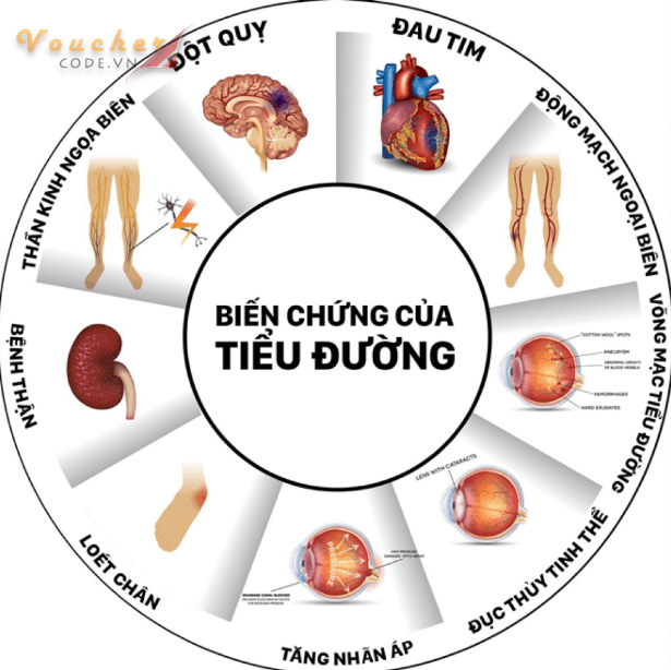 Thong-tin-ve-benh-tieu-duong- 4