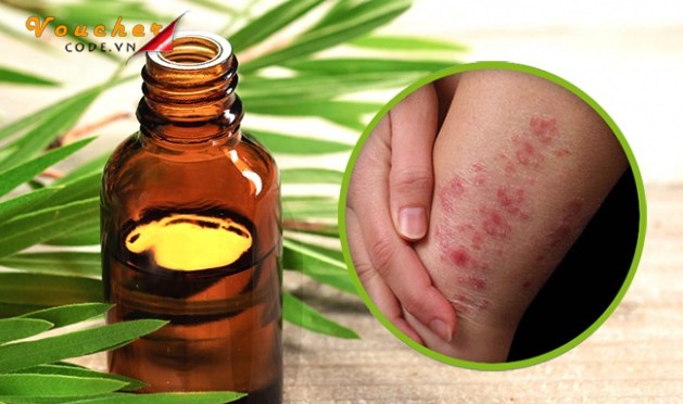 Tinh dau la gi 5 Tinh dau la gi 5