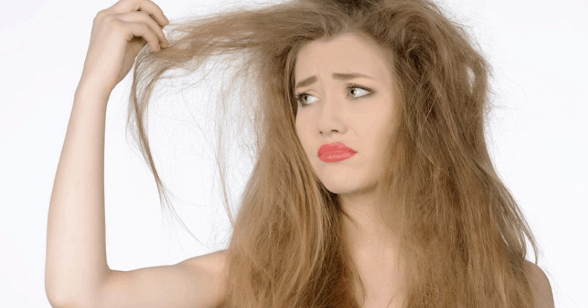 Top 10 dầu gội trị gàu tốt nhất, giảm gàu nhanh chóng sau 1 tuần