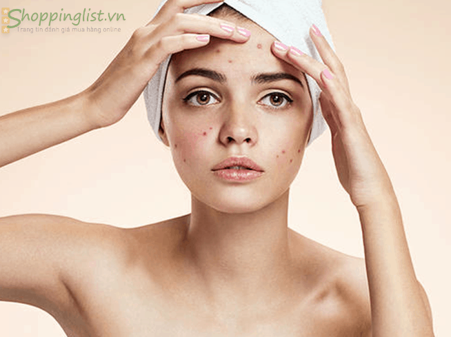 Kem-chong-nang-tot-nhat-cho-da-dau-mun-2