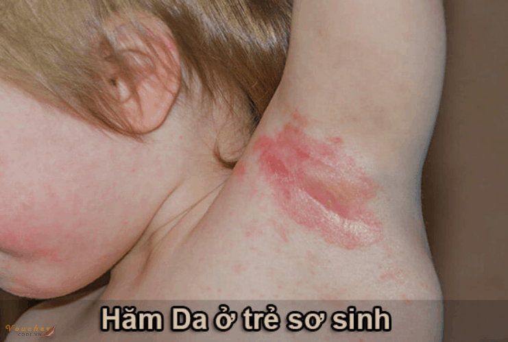 kem-tri-ham-da-cho-tre-so-sinh-loai-nao-tot-1