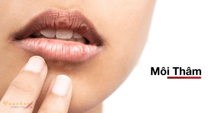 son-tri-tham-moi-tot-nhat-1