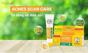 kem-tri-tham-mun-tot-nhat-2