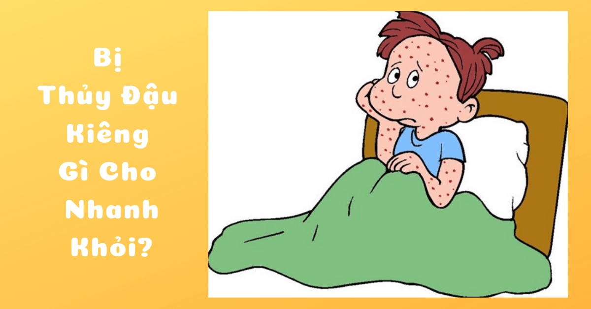 Thủy đậu nên kiêng gì để nhanh khỏi và không bị sẹo