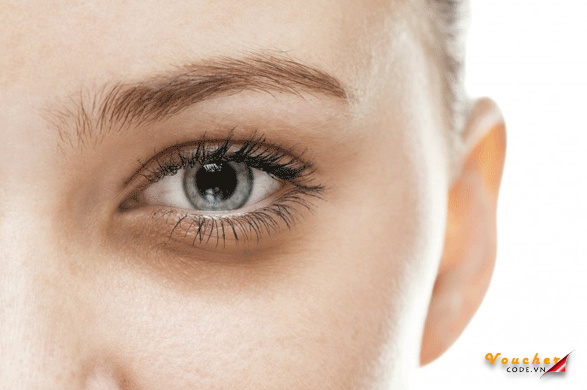 Kem Tri Nep Nhan Vung Mat Tot Nhat 1