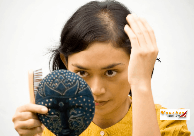 Thuoc Moc Toc Tot Nhat 1