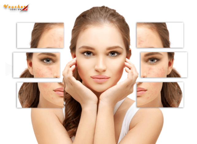 Kem Tri Seo Ro Tot Nhat 16