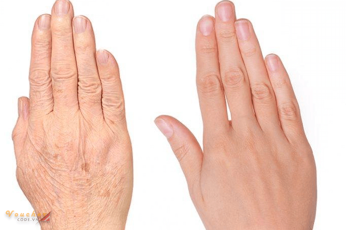 kem lam mem da tay 2